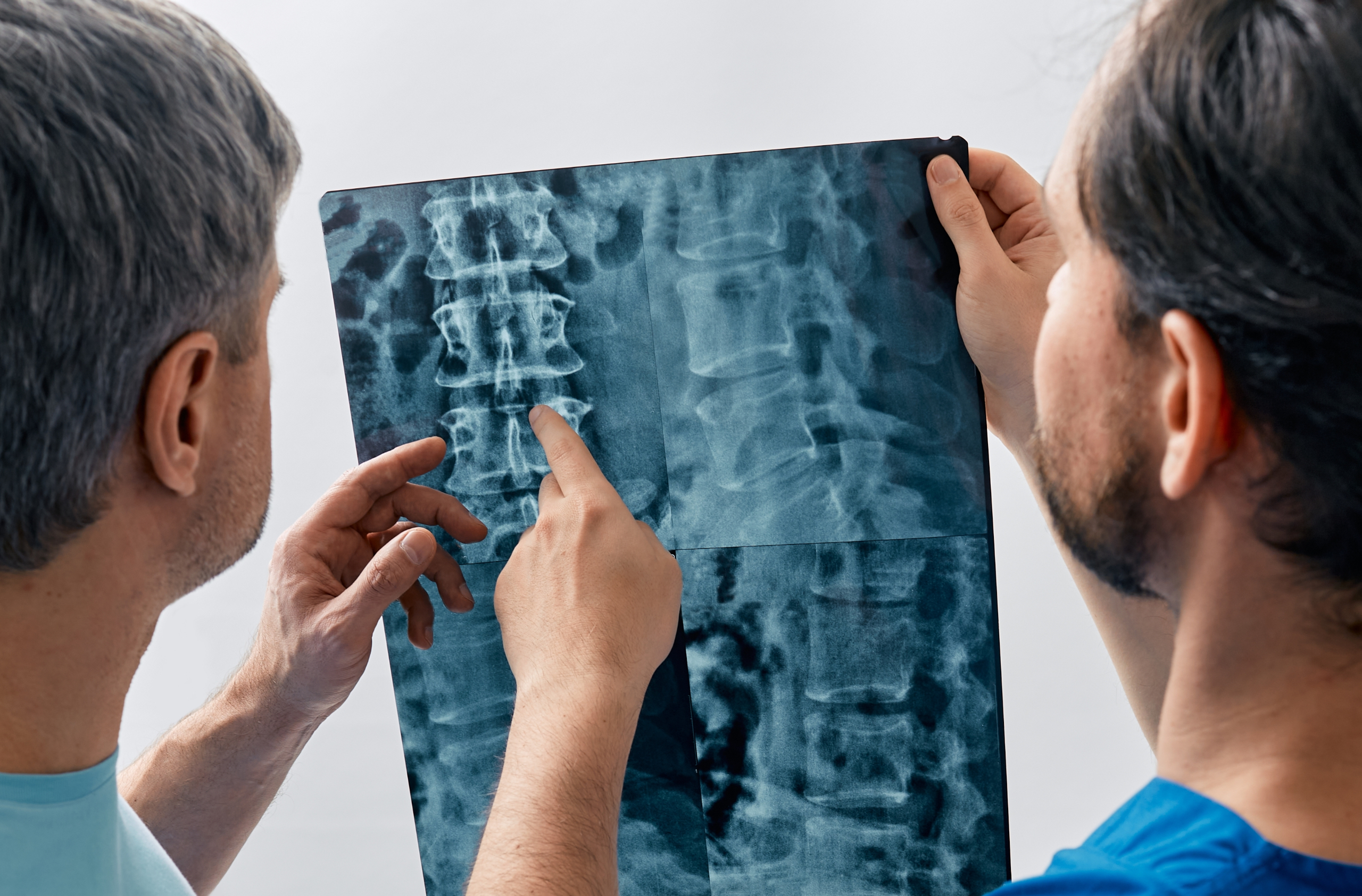 Philadelphia Spinal Cord Injuries Attorney